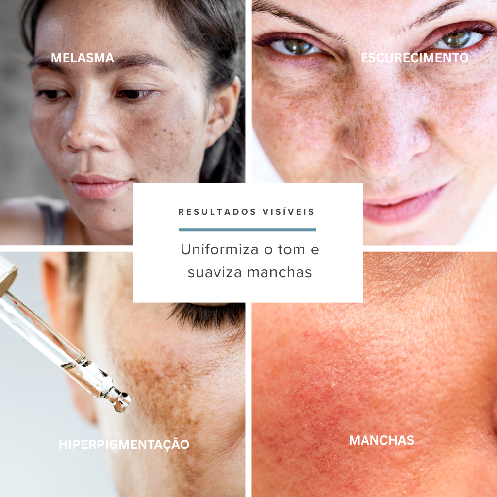 Kit Melasma e Manchas