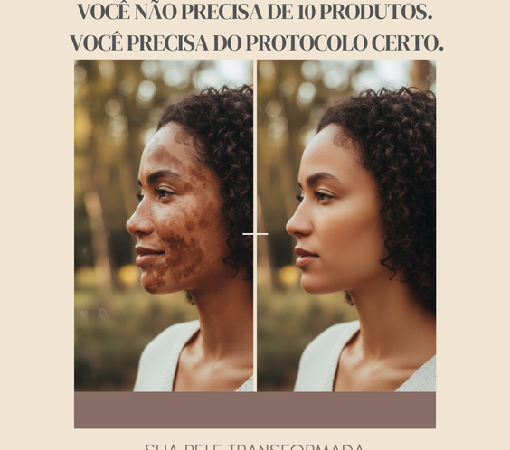 Kit Melasma e Manchas