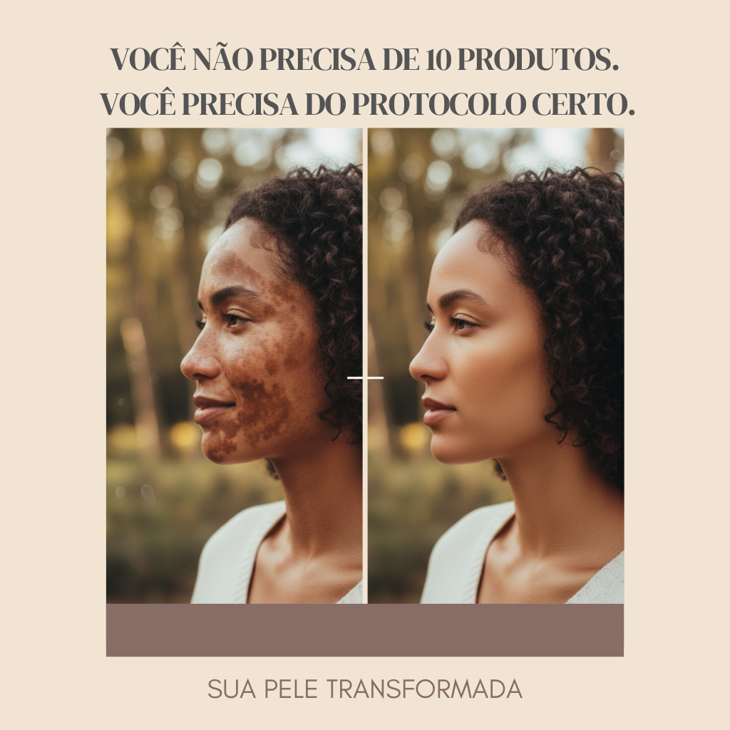 Kit Melasma e Manchas
